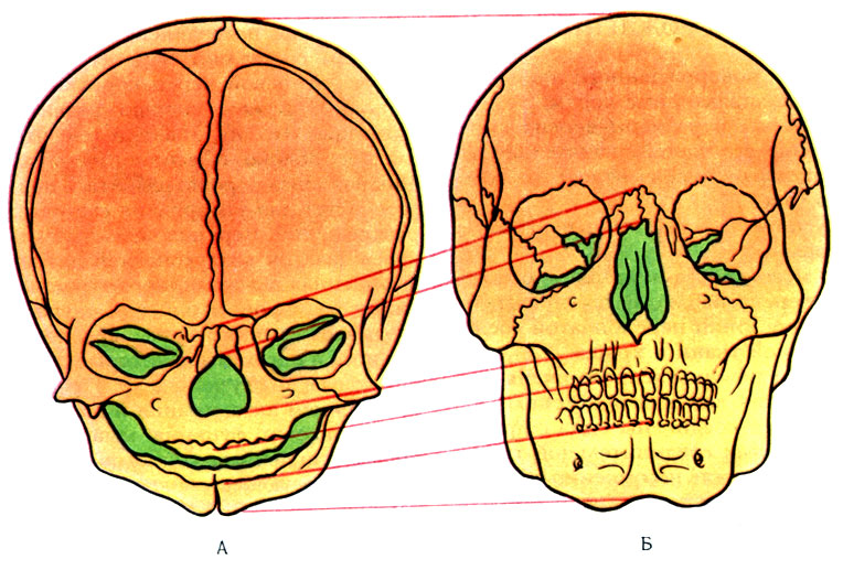 Кости черепа новорожденного