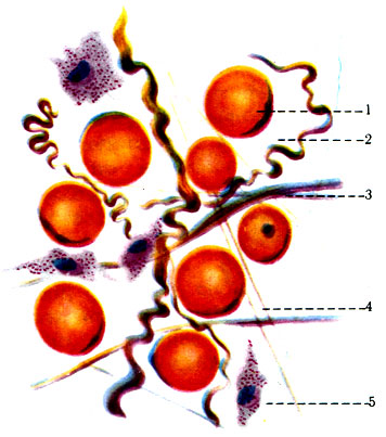 11. Жировая ткань. 1 - жировые клетки; 2 - ядро клетки; 3 - коллагеновые волокна; 4, 5 - эластические волокна