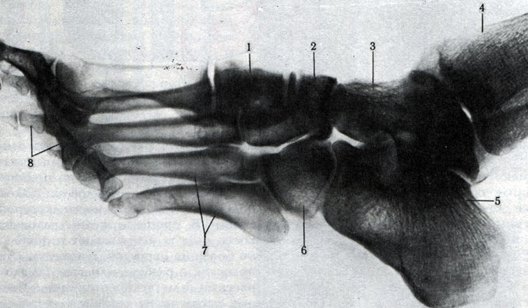 32 а. Рентгенограмма стопы. 1 - медиальная клиновидная кость; 2 - ладьевидная кость; 3 - таранная кость; 4 - большеберцовая кость; 5 - пяточная кость; 6 - кубовидная кость; 7 - кости предплюсны; 8 - фаланги