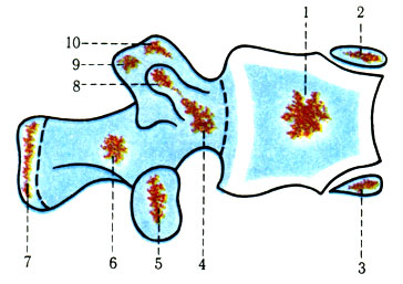 42. Схема окостенения поясничного позвонка (по Андронеску). 1 - первичное среднее ядро; 2 - верхнее эпифизарное кольцо окостенения; 3 - нижнее эпифизарное кольцо; 4 - первичное переднелатеральное и поперечное ядра окостенения; 5 - вторичное нижнесуставное ядро; 6 - первичное заднелатеральное ядро; 7 - вторичное ядро окостенения остистого отростка; 8 - вторичное поперечное ядро; 9 - вторичное ядро окостенения сосцевидного отростка; 10 - вторичное верхнесуставное ядро окостенения