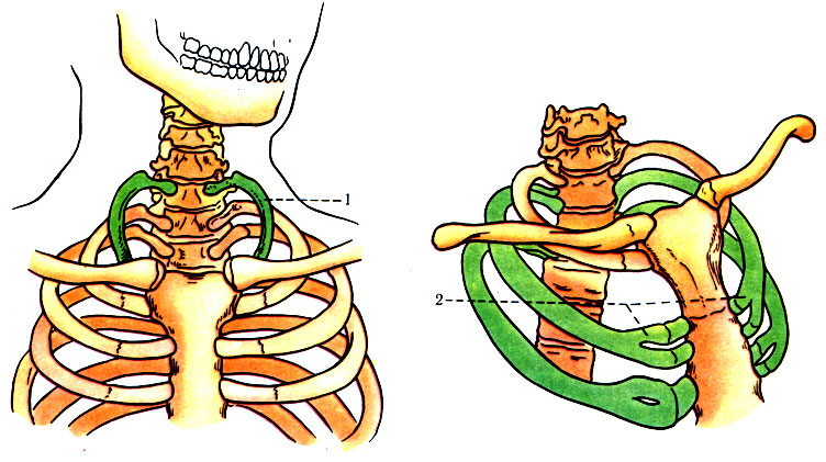 44. Аномалии ребер. 1 - добавочное шейное ребро (по Корнингу); 2 - раздвоенное ребро (по Арею)