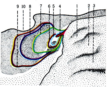47. Схема возрастных изменений объема воздухоносной пазухи клиновидной кости (по Torigiani) 1 - верхняя носовая раковина; 2 - средняя носовая раковина; 3 - нижняя носовая раковина; 4 - граница пазухи у новорожденного; 5 - в 3 года; 6 - в 5 лет; 7 - в 7 лет; 8 - в 12 лет; 9 - у взрослого; 10 - турецкое седло
