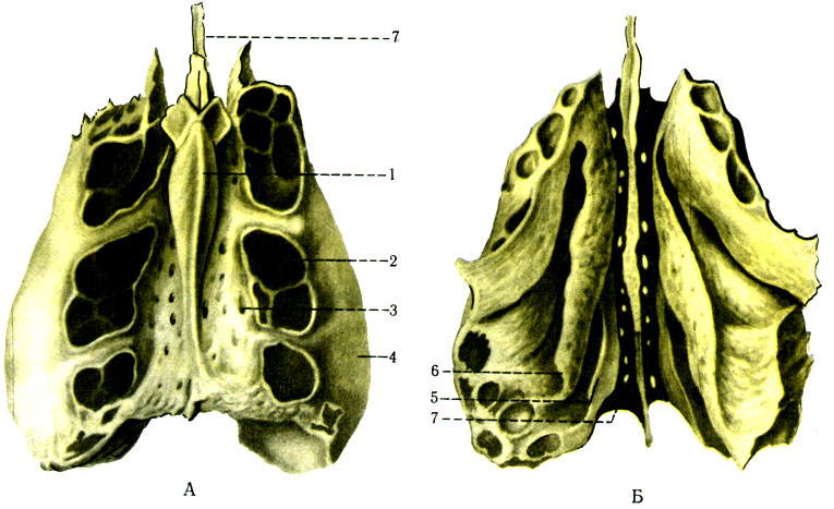 49. Решетчатая кость. А - вид сверху; Б - вид снизу: 1 - crista galli; 2 - labyrinthitis ethmoidalis; 3 - lamina cribrosa; 4 - lamina orbitalis; 5 - concha nasalis superior; 6 - concha nasalis media; 7 - lamina perpendicularis