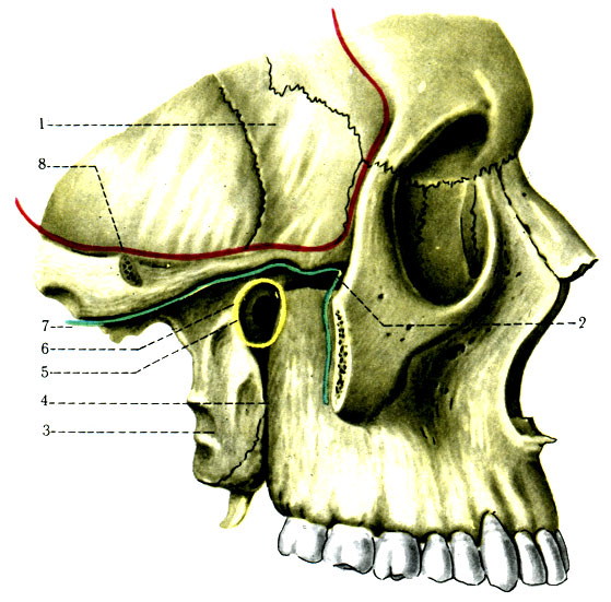 64. Височная (fossa temporalis), подвисочная (fossa infratemporalis), крылонебная (fossa pterygopalatina) ямки. 1 - ala major ossis sphenoidalis; 2 - fissura orbitalis inferior; 3 - lamina lateralis processus pterygoidei; 4 - tuber maxillae; 5 - for. sphenopalatinum; 6 - fossa pterygopalatina (желтая линия); 7 - fossa infratemporal (зеленая линия); 8 - fossa temporalis (красная линия)