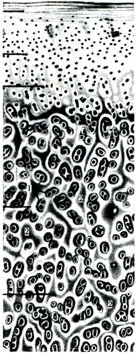 101 А. Строение суставного хряща (по Goerttler). 1 - хрящевые клетки; 2 - промежуточное вещество гиалинового хряща