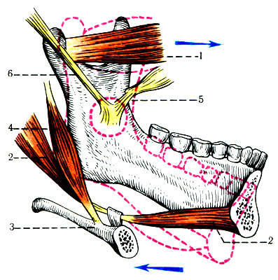 118. Нижняя челюсть как рычаг (по В. П. Воробьеву). 1 - m. pterygoideus lateralis; 2 - m. digastricus; 3 - os hyoideum; 4 - m. stylohyoideum; 5 - lig. sphenomandibulare; 6 - lig. stylomandibulare