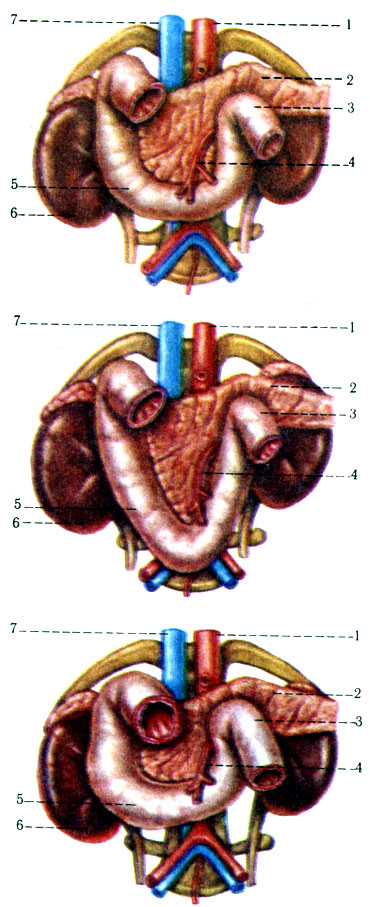 244. Варианты формы двенадцатиперстной кишки. 1 - аорта; 2 - pancreas; 3 - flexura duodenojejunalis; 4 - a. mesenterica superior; 5 - duodenum; 6 - ren; 7 - v. cava inferior