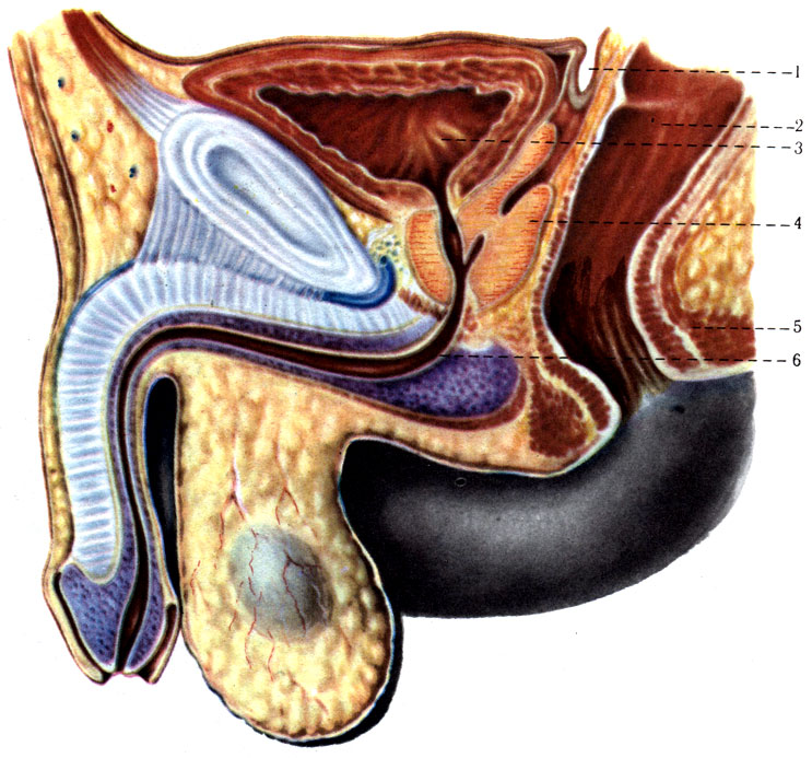 279. Отношение брюшины малого таза на сагиттальном распиле у мужчины (схема). 1 - excavatio г ectovesicalis; 2 - rectum; 3 - vesica urinaria; 4 - prostata; 5 - m. sphincter ani externus; 6 - urethra