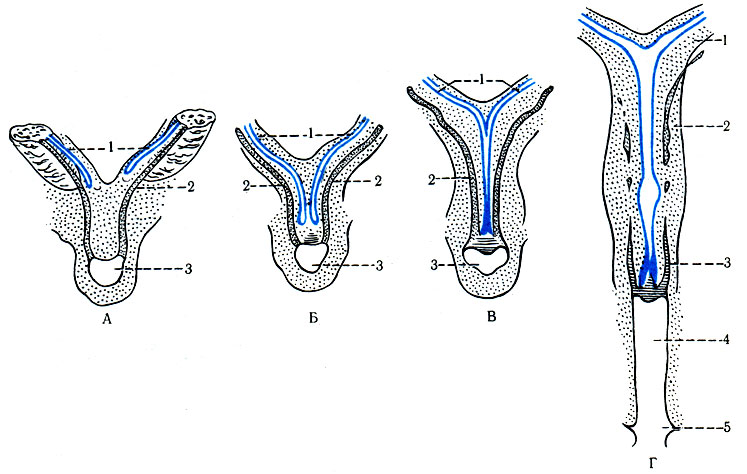 344. Схематическое изображение образования матки, влагалища и мезонефральных протоков. А, Б, В: 1 - мезонефральный проток; 2 - проток средней почки; 3 - мочеполовая пазуха. Г: 1 - маточная труба; 2 - тело матки; 3 - шейка матки; 4 - влагалище; 5 - мочеполовая пазуха