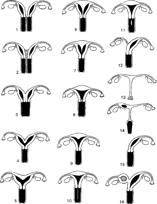 Половые хромосомы: численные и структурные аномалии