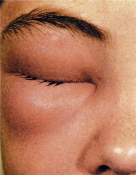 Глазные заболевания и проблемы со зрением
