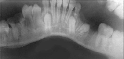 Практическое задание по теме Острый гнойный периостит правой верхней челюстной кости