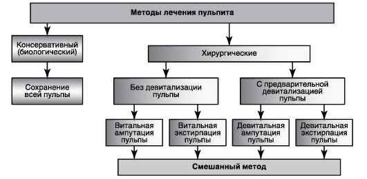 Схема лечения пульпита